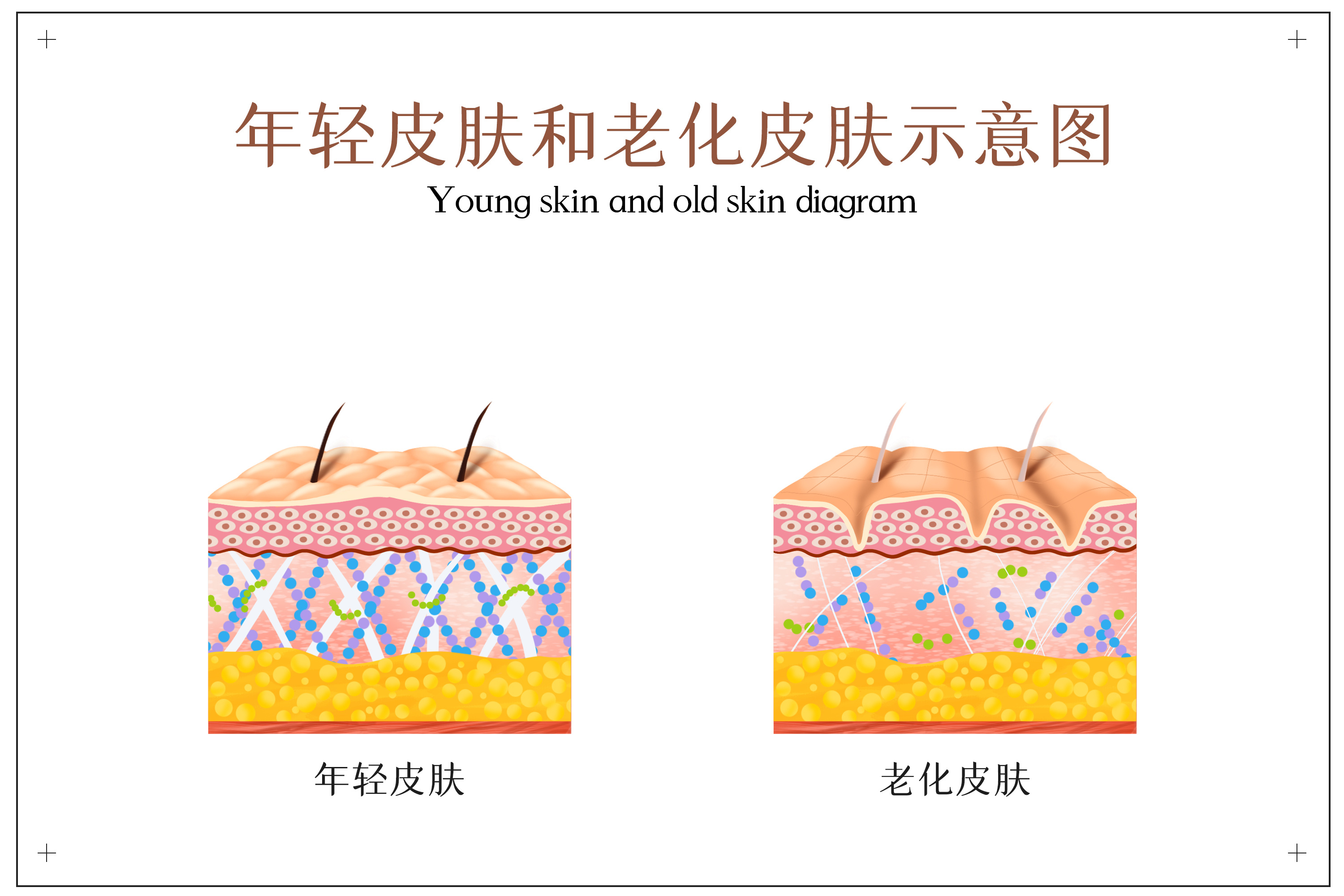 摄图网_401794784_年轻皮肤和老化皮肤示意图（企业商用）.jpg